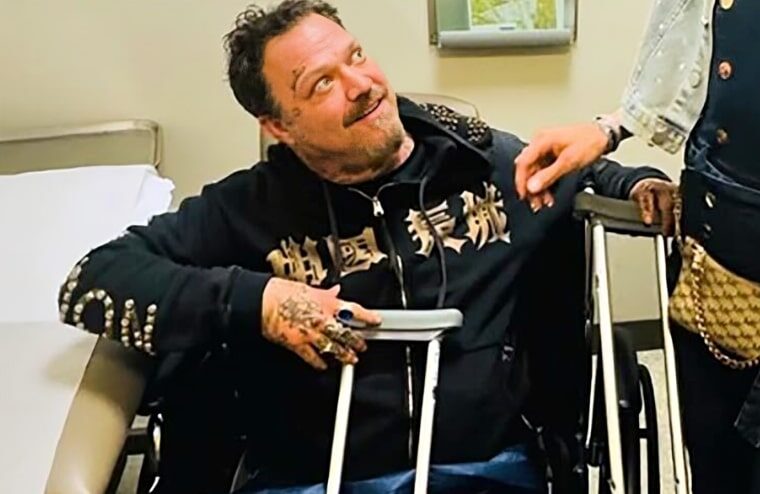 Ex-“Jackass” Star Bam Margera Suffers Nasty Skateboarding Injury (w/Video)