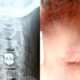 AEW Original Reveals He’s Undergone Neck Surgery