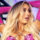 Carmella Shows The Brutal Aftermath Of Recent Eye Surgery