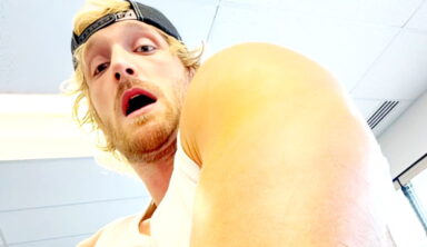 Logan Paul Shows Off Gruesome Tricep Surgery Bruising
