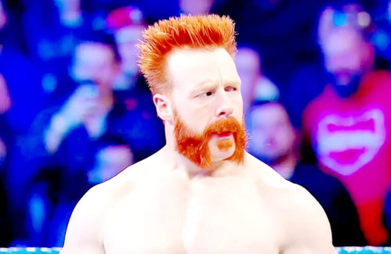 Sheamus Shares Graphic Photos Of Nasty Head Gash After Gym Accident