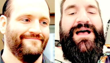 Controversial Wrestler-Turned-YouTuber Streams His Penis Enlargement Surgery