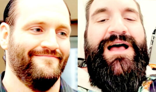 Controversial Wrestler-Turned-YouTuber Shares Footage From His Penis Enlargement Surgery
