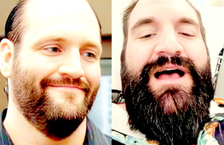 Controversial Wrestler-Turned-YouTuber Streams His Penis Enlargement Surgery